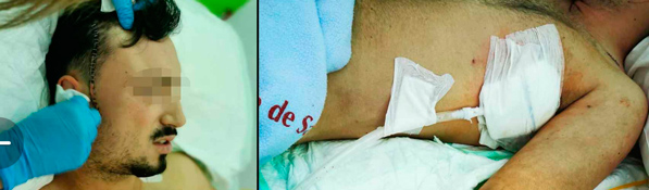 Homicida en libertad tras apuñalar en Águilas